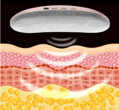 Almohadilla Termica Banda Para Colicos